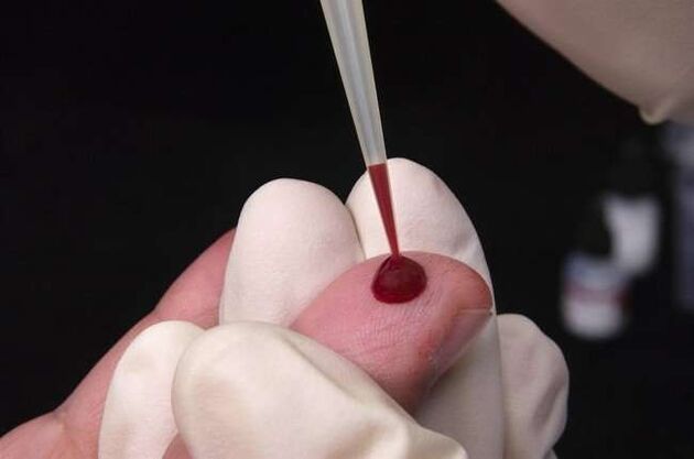 сбор крови для тестирования на паразитов